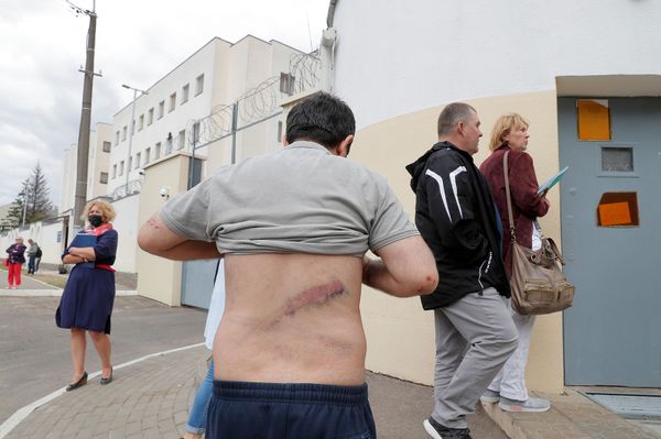 Гражданин Армении попал под раздачу силовиков в Минске, его избили на Окрестина Гражданин Армении попал под раздачу силовиков в Минске, его избили на Окрестина - Sputnik Армения