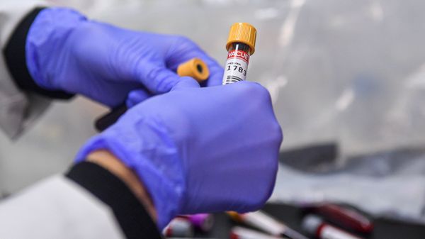 Лаборант держит в руках пробирку с пробой на антитела к COVID-19 - Sputnik Армения