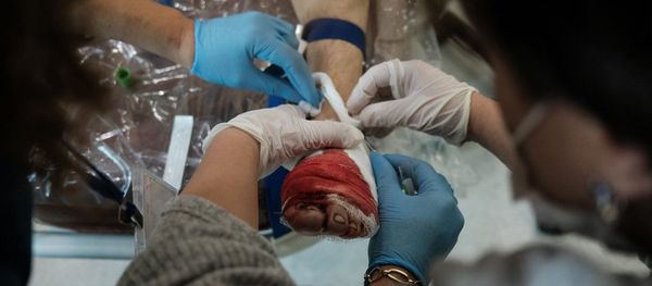Медработники оперируют раненного мужчину во время обстрелов медицинского центра Степанакерта (28 октября 2020). Карабах - Sputnik Արմենիա