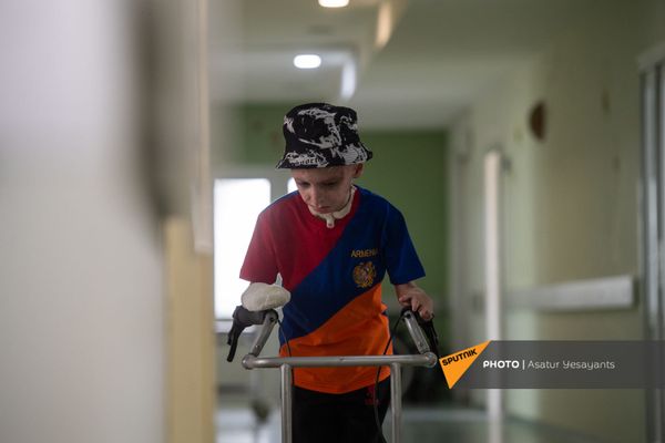 8-летний Ваге Мосинян, получивший 80% ожогов в дорожно-транспортном происшествии, выписывается из больницы через год 8-летний Ваге Мосинян, получивший 80% ожогов в дорожно-транспортном происшествии, выписывается из больницы через год - Sputnik Армения