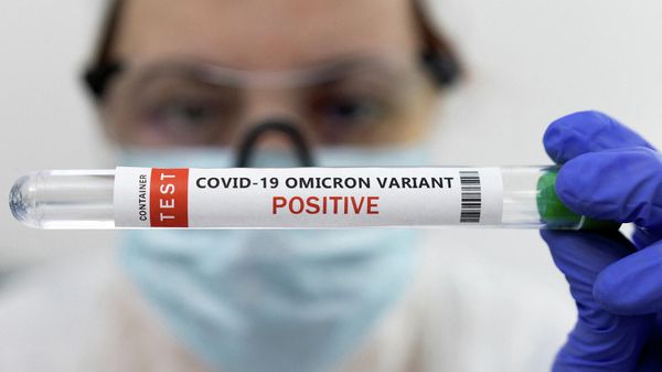COVID-19 թեստ - Sputnik Արմենիա