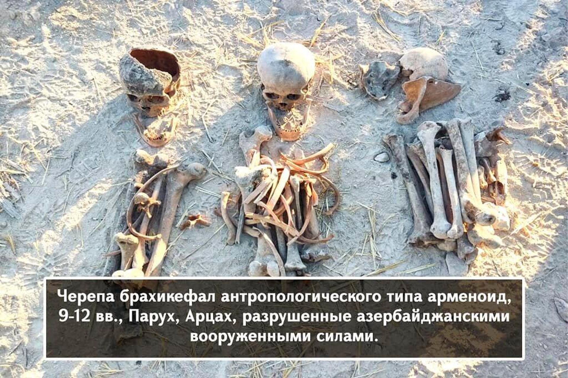 Черепа брахикефал антропологического типа арменоид, 9-12 века, Парух, Арцах, разрушенные азербайджанскими ВС - Sputnik Армения, 1920, 02.04.2022