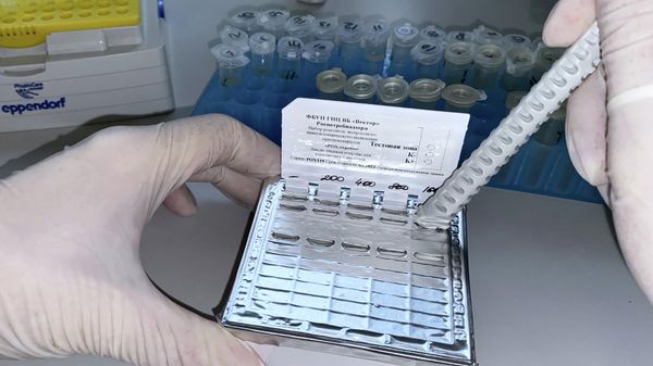 Научный центр Вектор создал тест-системы для выявления случаев заражения оспой обезьян - Sputnik Армения