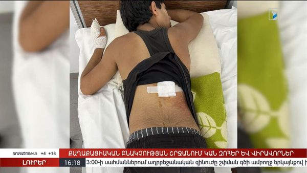 Общественное телевидение Армении опубликовало фотографии получивших ранения детей в Нагорном Карабахе  - Sputnik Армения