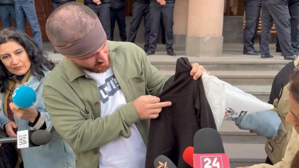 Улубабян назовет СК имена двух полицейских, избивших его в отделении в Ванадзоре  - Sputnik Армения