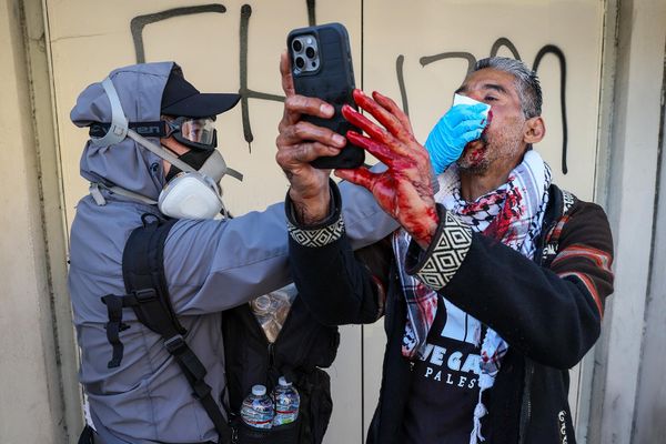 Получивший ранение активист во время акции протеста против иммиграционной политики администрации Трампа (8 июня 2025). Лос-Анджелес - Sputnik Армения