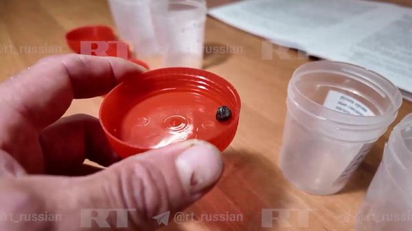 Хирурги извлекают металлические шарики у пострадавших при террористической атаке ВСУ на склад Wildberries в Тамбовской области.  - Sputnik Армения