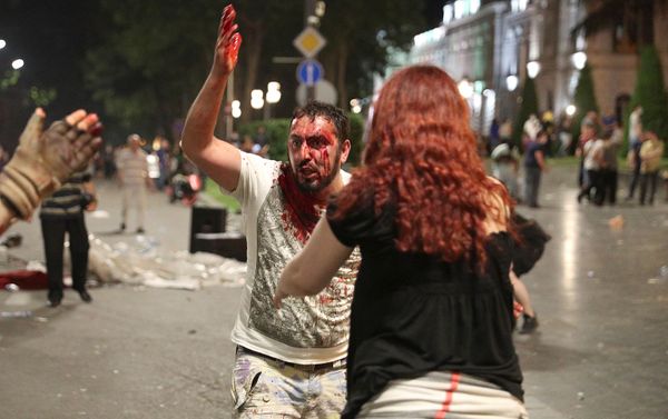 Раненный активист на митинге против визита российского депутата Грузию (21 июня 2019). Тбилиси Раненный активист на митинге против визита российского депутата Грузию (21 июня 2019). Тбилиси - Sputnik Армения