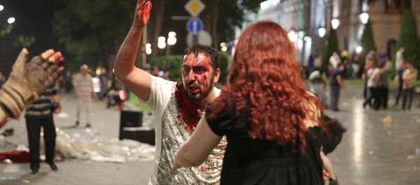 Раненный активист на митинге против визита российского депутата Грузию (21 июня 2019). Тбилиси Раненный активист на митинге против визита российского депутата Грузию (21 июня 2019). Тбилиси - Sputnik Армения