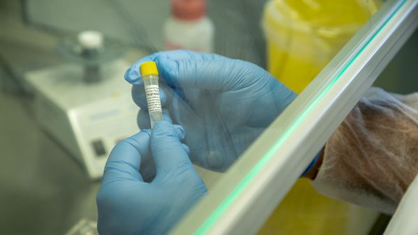 Тест по выявлению коронавируса в Национальном центре по контролю и профилактике заболеваний Тест по выявлению коронавируса в Национальном центре по контролю и профилактике заболеваний - Sputnik Армения
