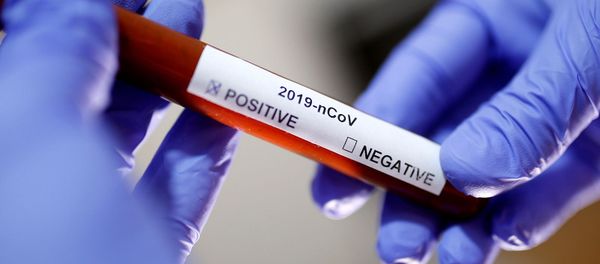 Инсценировка пробирки с положительным результатом теста на короновирус Инсценировка пробирки с положительным результатом теста на короновирус - Sputnik Армения