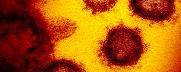 На снимке с помощью электронного микроскопа виден новый коронавирус SARS-CoV-2, появляющийся на поверхности клеток. Он вызывает COVID-19 - Sputnik Армения