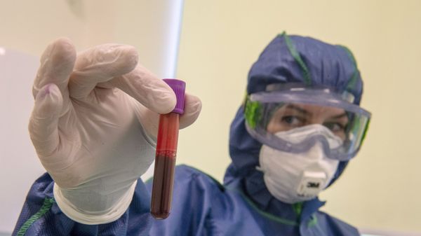 Экспресс-диагностика на антитела к коронавирусу в клинике Hadassah Medical Moscow в Сколково - Sputnik Армения