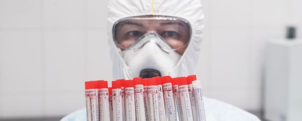 Врач с пробирками биоматериала после тестирования на коронавирус Врач с пробирками биоматериала после тестирования на коронавирус - Sputnik Армения