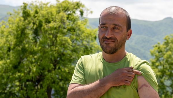 Встретивший леопарда в лесах близ села Енокаван Арман Габриелян показывает шрам на предплечье - Sputnik Армения