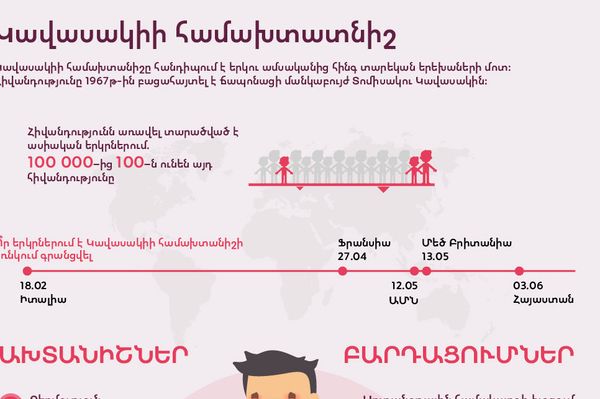 Կավասակիի համախտատնիշ - Sputnik Արմենիա