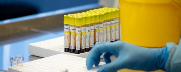 Лаборатория для проведения тестов на антитела к коронавирусу в Республиканском центре профилактики СПИДа Лаборатория для проведения тестов на антитела к коронавирусу в Республиканском центре профилактики СПИДа - Sputnik Армения
