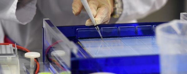 Разработка вакцины от коронавируса - Sputnik Արմենիա